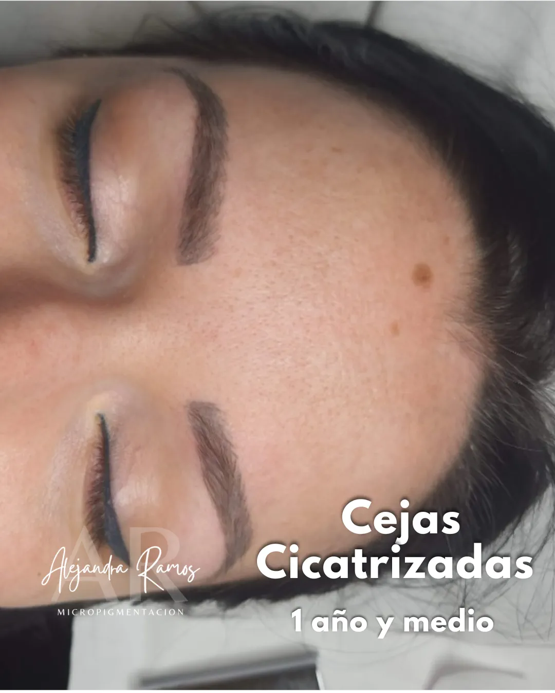 Cejas micropigmentadas ya cicatrizadas, año y medio después del tratamiento