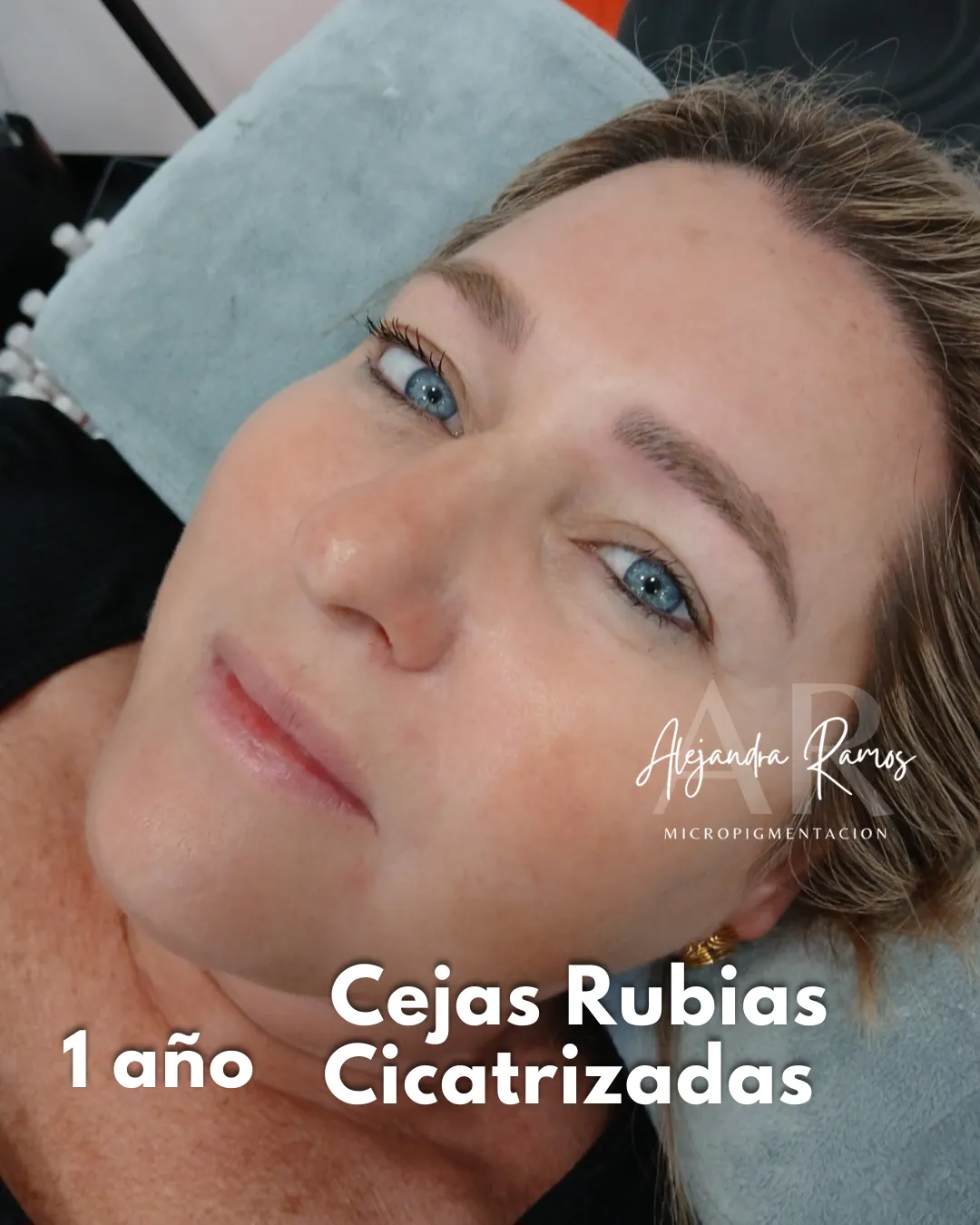Clienta rubia con cejas micropigmentadas en tono claro, cicatrizadas un año después
