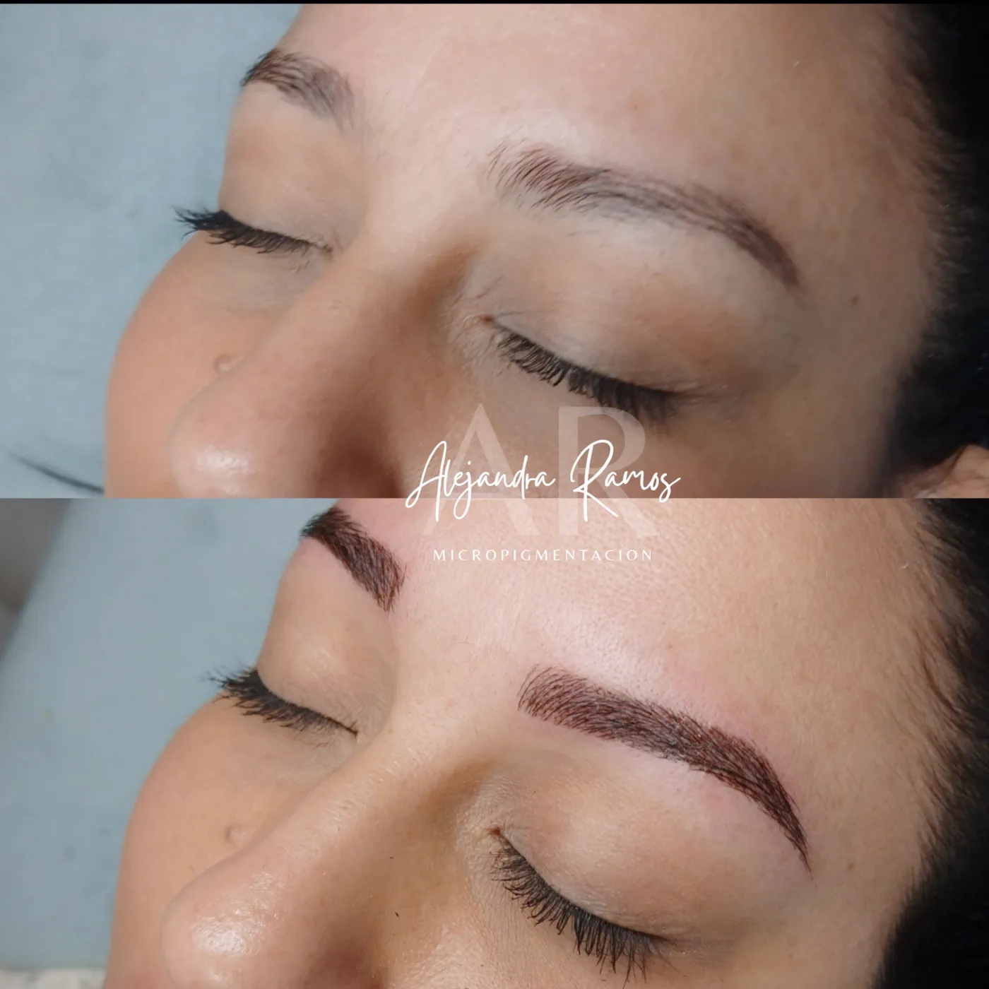 Antes y después de un microblading que rellena las zonas sin vello