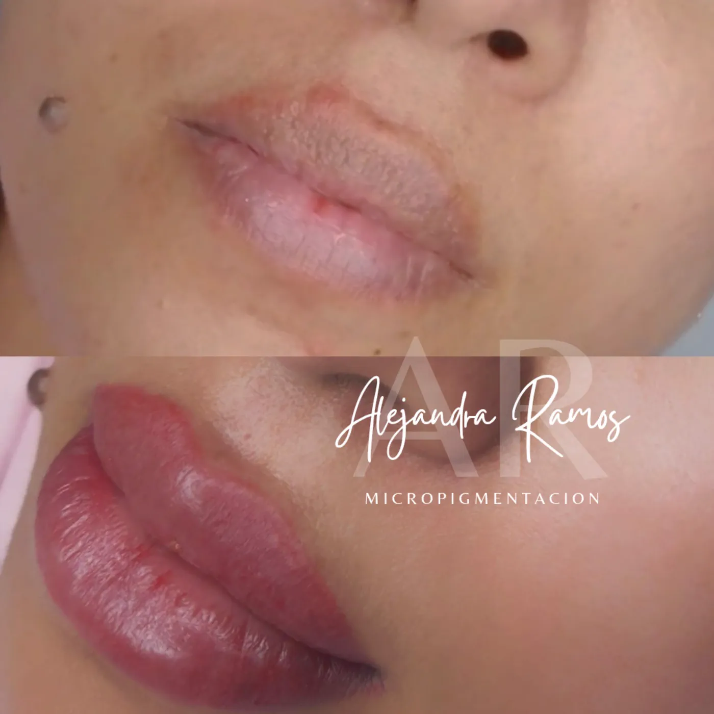 Antes y después de una micropigmentación de labios que recupera color y contorno