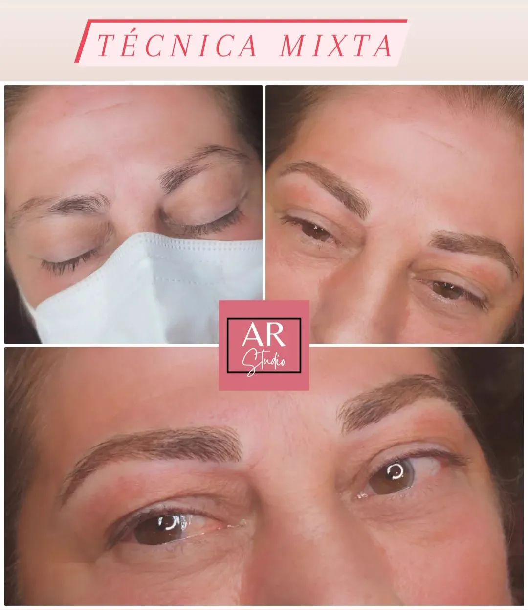 Antes y después de cejas con técnica mixta, combinando pelo a pelo y sombreado